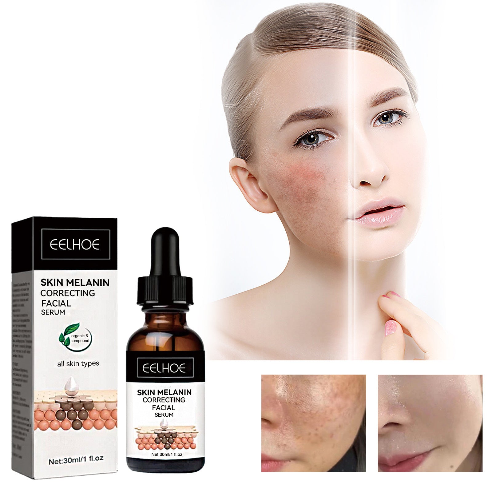 Facial Melanin Repair Hydrating Skincare Products - IceAndFire