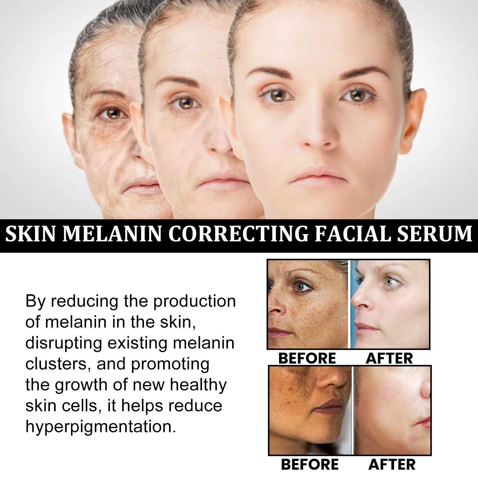 Facial Melanin Repair Hydrating Skincare Products - IceAndFire